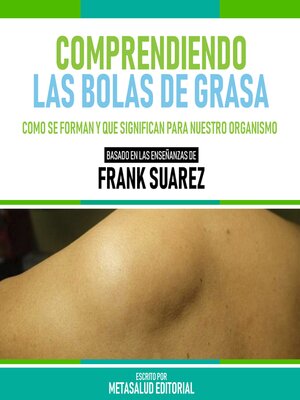 cover image of Comprendiendo Las Bolas De Grasa--Basado En Las Enseñanzas De Frank Suarez